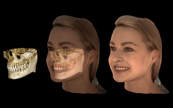 Face Scan